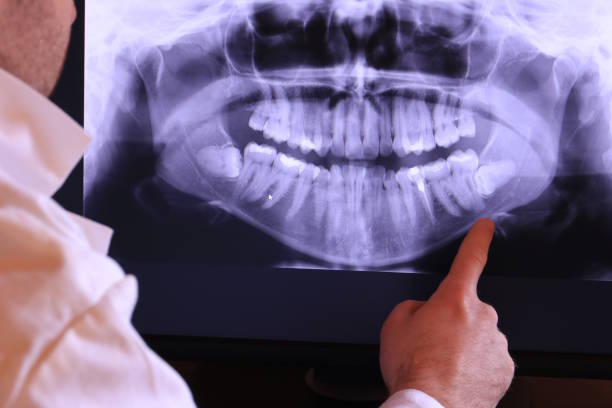 Best Emergency Treatment for Dental Infections or Abscesses in Newington, VA